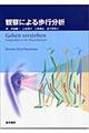 観察による歩行分析