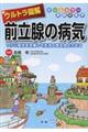 �E���g���}��O���B�̕a�C