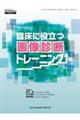 �Տ��ɖ𗧂摜�f�f�g���[�j���O
