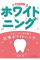知りたい!ホワイトニング